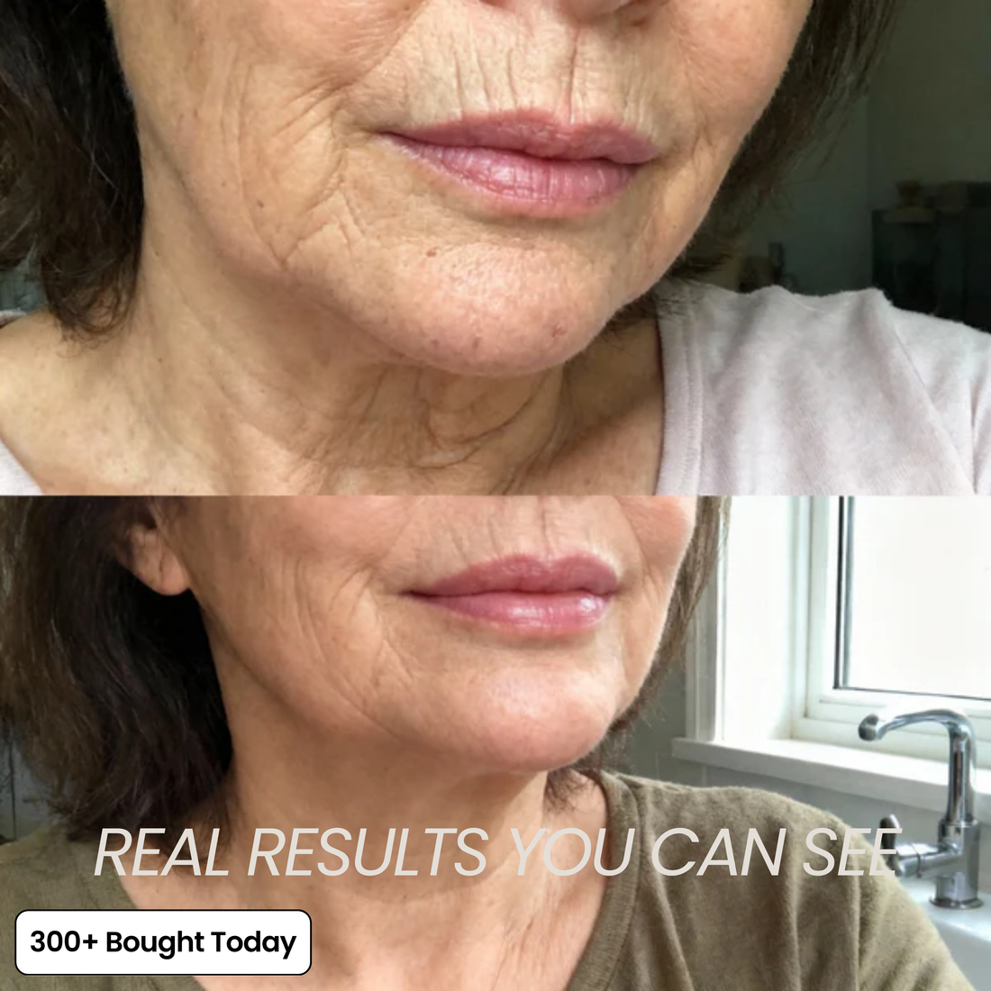 Vynelle Plump & Glow Balm