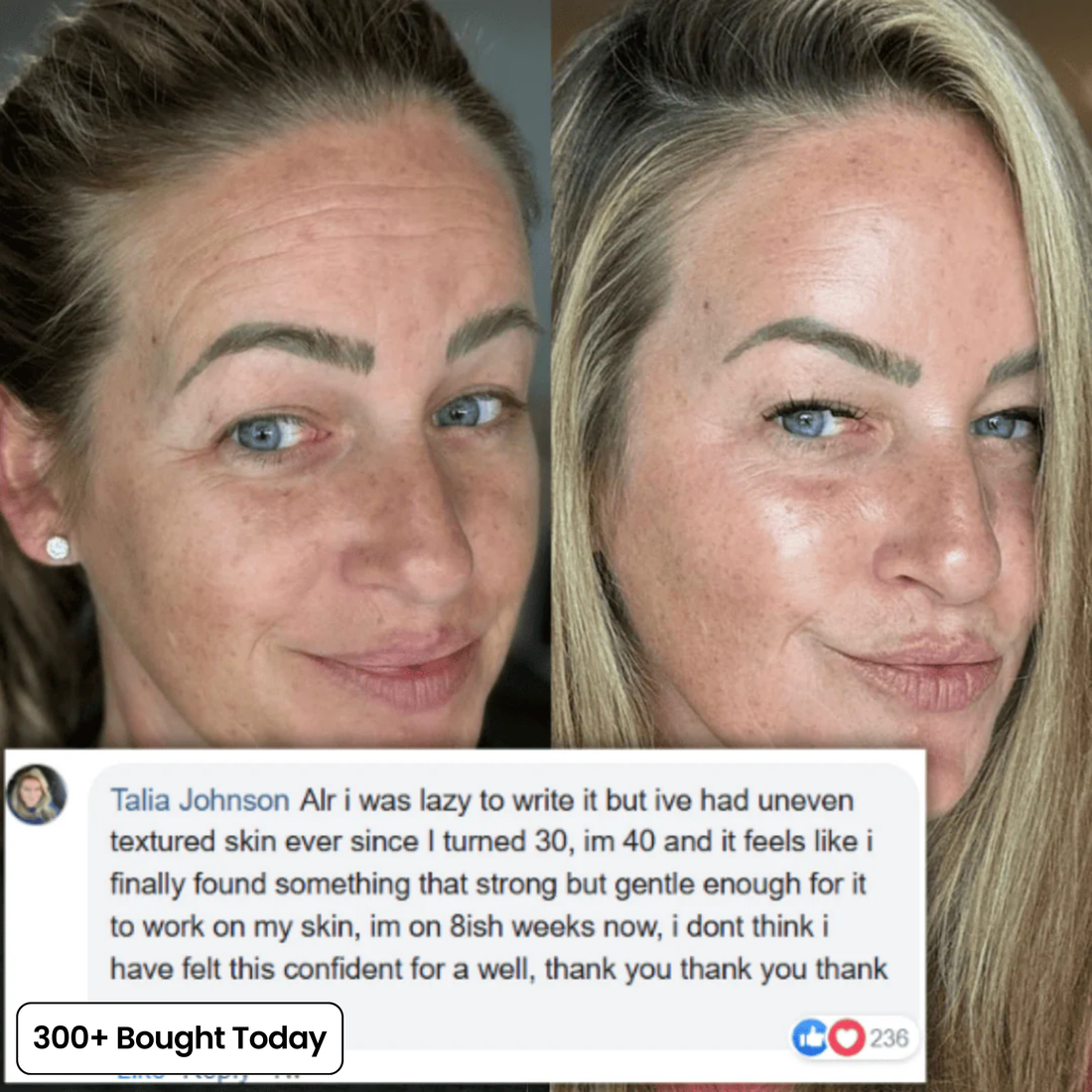 Vynelle Plump & Glow Balm
