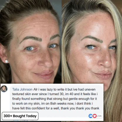 Vynelle Plump & Glow Balm